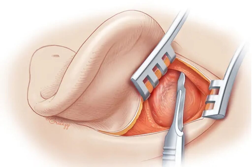 ear infection treatment