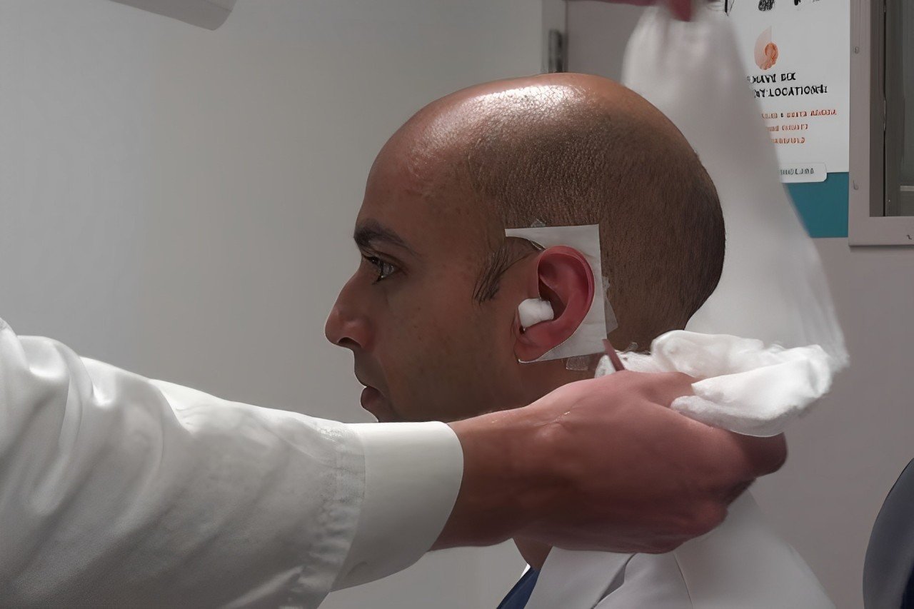 Effective ear infection treatment at MICRO ENT Hospital, offering comprehensive care for all types of ear infections.
