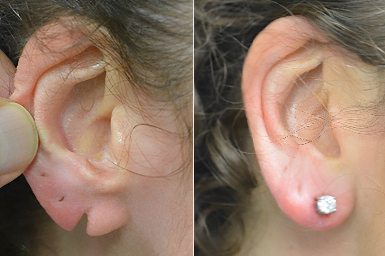 best hospital for ear surgeries in hyderabad