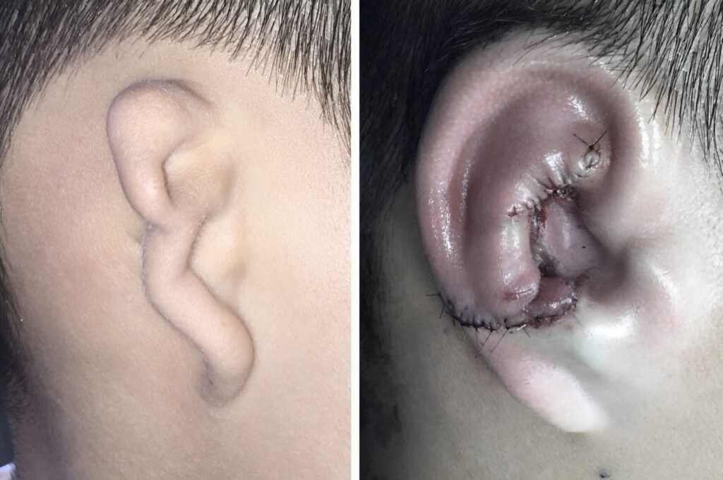 best hospital for ear surgeries in hyderabad