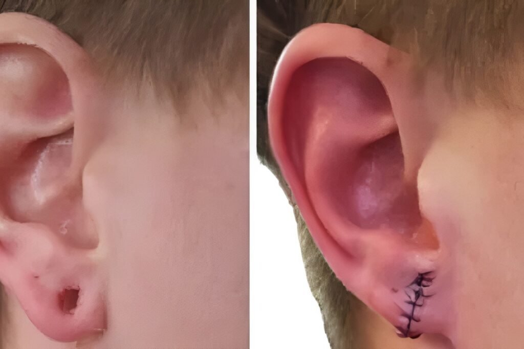 hospital for ear services in tolichowki