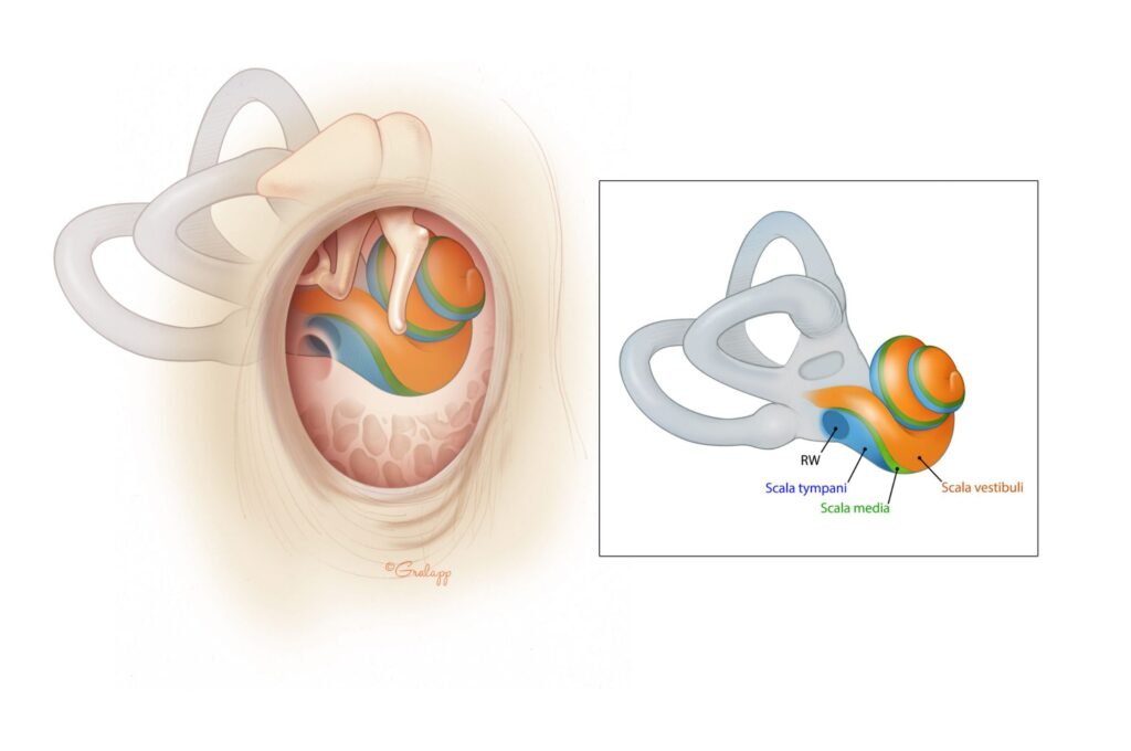 Effective ear infection treatment at MICRO ENT Hospital, offering comprehensive care for all types of ear infections.