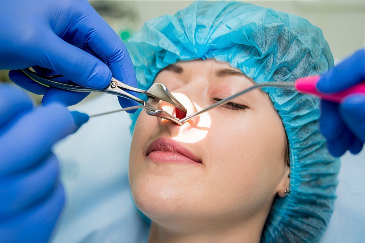 "Expert care for all types of nose treatment at Micro ENT Hospital.