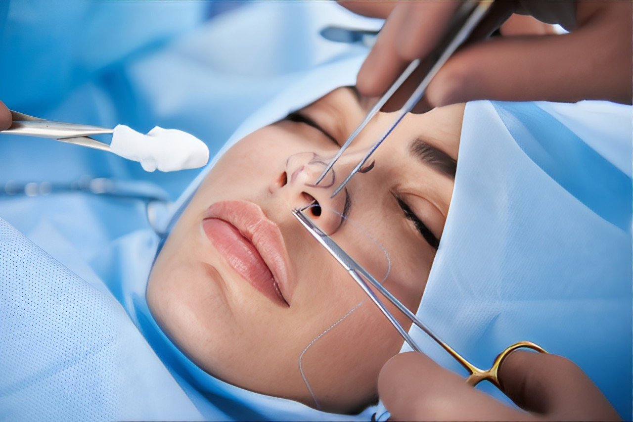 Expert care at the best hospital for nose surgery in Tolichowki.