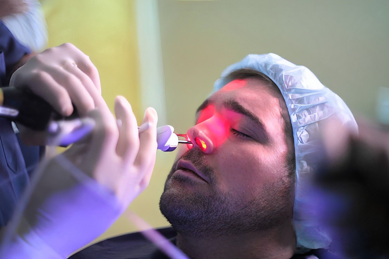 Best hospital for nose treatment in Hyd - Micro ENT Hospital.
